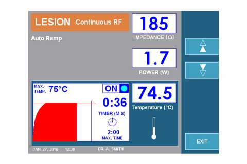 URF-3AP Lesion Continuous RF