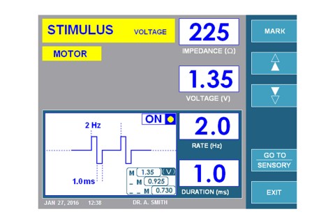 URF-3AP Stimulus Motor