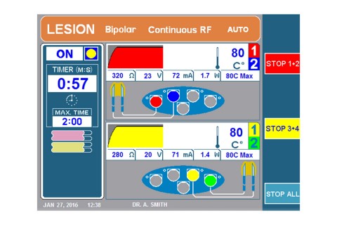 URF-3AP + MLA-4 Lesion Dual Bipolar