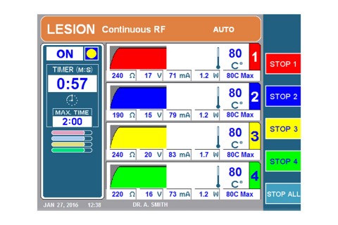 URF-3AP + MLA-4 Lesion C
