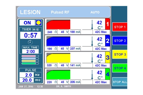 URF-3AP + MLA-4 Lesion Pulsed RF