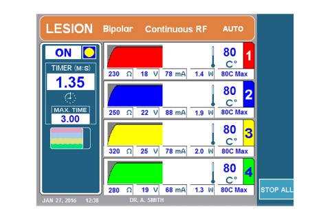 URF-3AP + MLA-4 Lesion Quadrapolar
